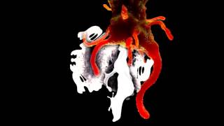 Amoebe  (Phyllomedusa) - Nostalgic Uridiuretijisms (In Retrospect) FULL ALBUM (2016 - Gorenoise)