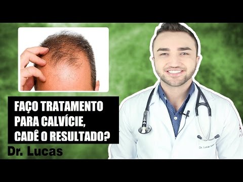 I'm undergoing treatment for baldness, how long will it take to see results? - Dr Lucas Fustinoni