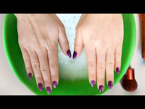 Как выглядят пигментные пятна на лице фото Девочка веснушка стихи