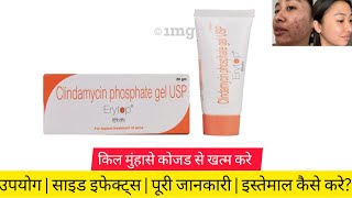 Erytop Gel: An effective medicine for treating pimples and acne. Uses, Side Effects, How to use i...