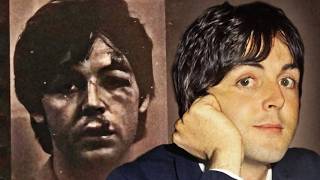Download lagu The Accident That Inspired Rocky Raccoon mp3