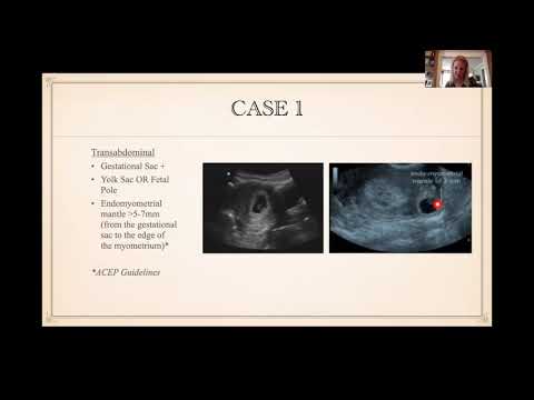 Ultrasound Case Review