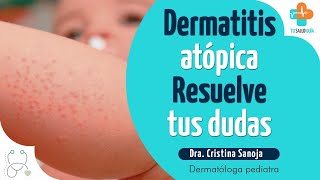 Dermatitis atópica - Resuelve tus dudas | Tu Salud Guía - Cristina Elizabeth Sanoja Valor