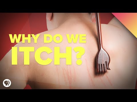 Why Do We Itch?