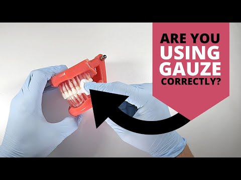 YouTube video about: How long do you leave gauze in after tooth extraction?