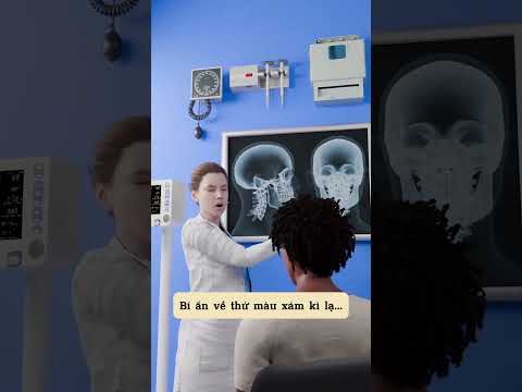 Trời ơi ghê quá 😰 sao lại có thể như vậy 😰 Cre: đâu đó trên Youtube