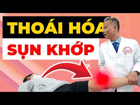 Acid uric tăng cao làm sụn khớp thoái hóa nặng hơn? Điều trị sao cho đúng?