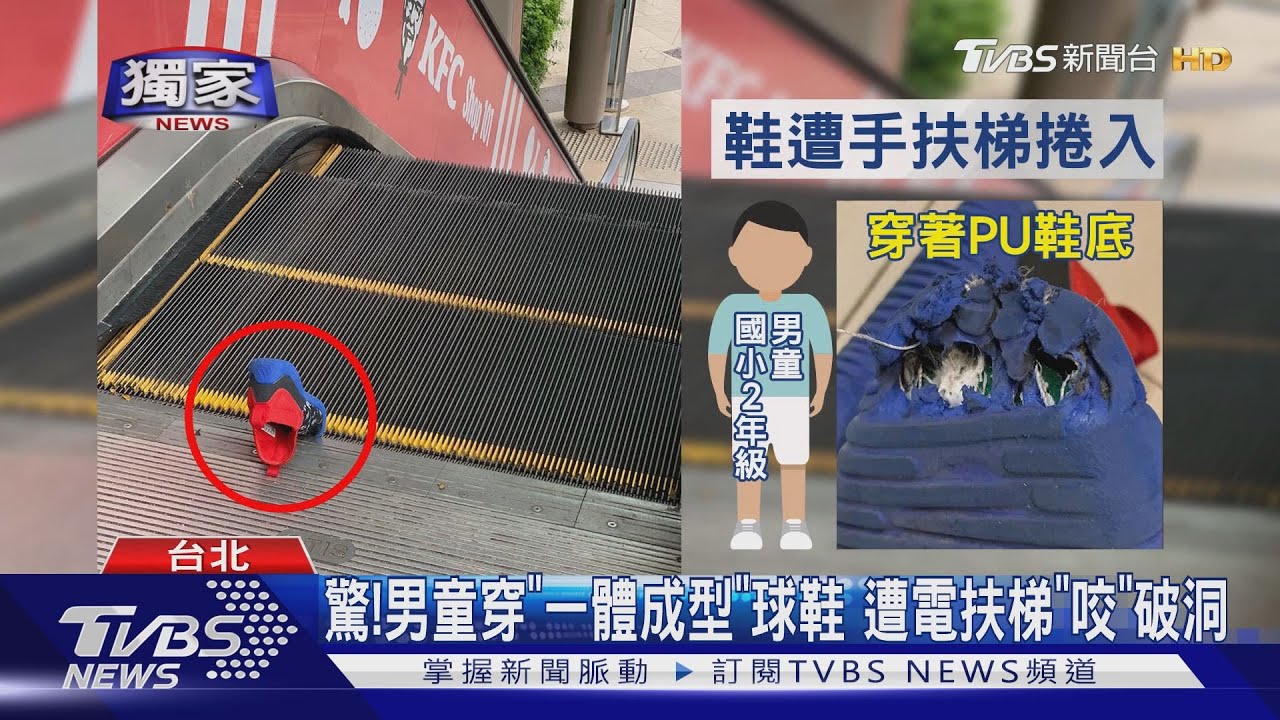 驚!男童穿「一體成型」球鞋 遭電扶梯「咬」破洞