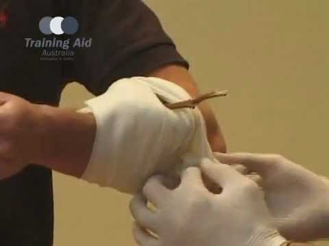 Bandaging - The Ring Bandage