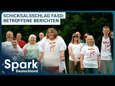 Alcohol during pregnancy - the consequences are so severe