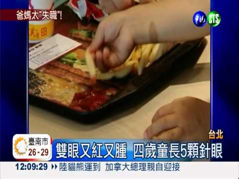 狂吃油炸食物 四歲童長5顆針眼