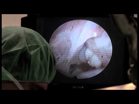 Dolore nel basso addome e parte bassa della schiena malata Sintomi osteocondrosi cervicale di spostamento