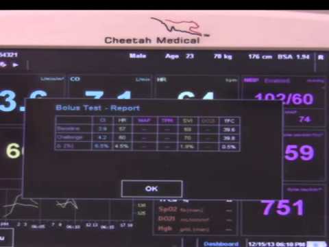 NICOM - Response to Fluid and Drug Administration