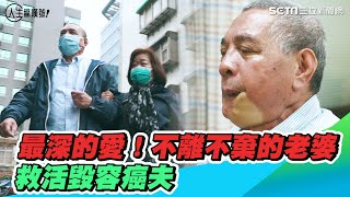 百年才修得共枕眠…妻不離不棄救活毀容癌夫