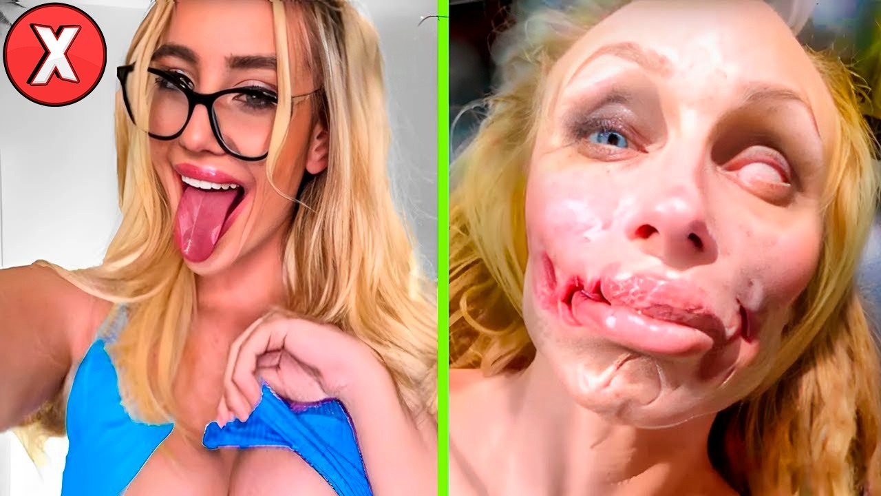 10 DESASTRES EM CIRURGIAS PLÁSTICAS DE FAMOSOS (Parte 4)