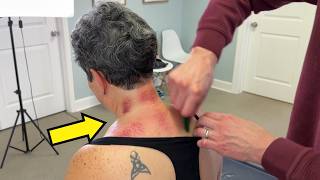 WORST Injury 😢 *Frozen Shoulder* & Stiff Neck Get RELIEF With Cracks & Deep Tissue Work!