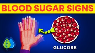 10 UNUSUAL Signs Your Blood Sugar is CONSTANTLY Too High