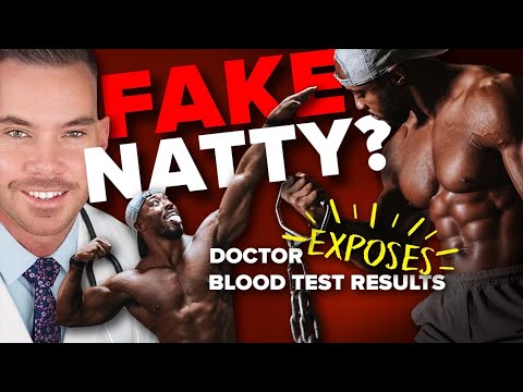 Signs of PED Abuse? Dr. Hotchkiss Analyzes Nsima’s Bloodwork || MBPP Ep. 929