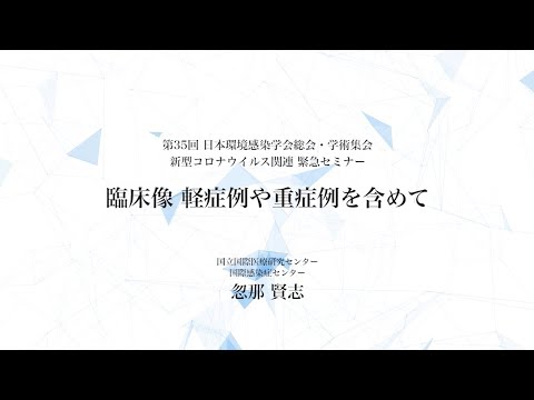 コロナウイルスは抜本的な対策を強いています – 多くの人がすでにこれらのことを懸念していました