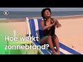 Hoe werkt zonnebrand?