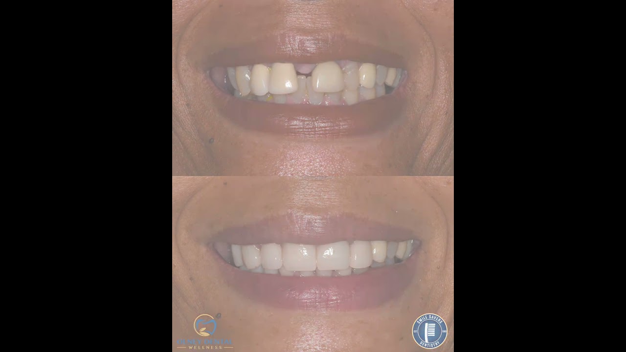 Smile Gallery Video 2