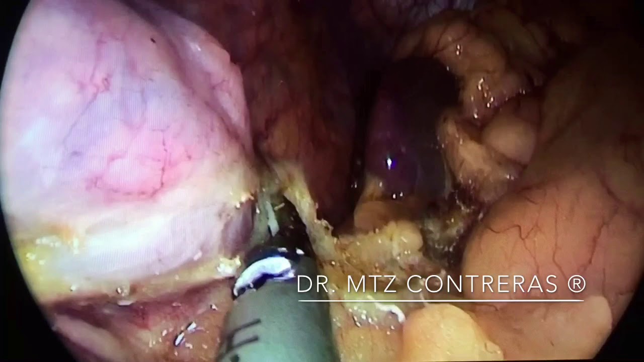 Arturo Martínez Contreras-9