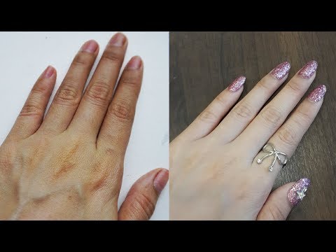 ครีมบนใบหน้าของ neurodermatitis โรคสะเก็ดเงินบนภาพฝ่าเท้า