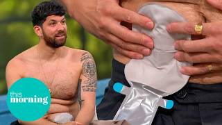The Influencer Breaking the Stigma Around Stoma Bags | This Morning
