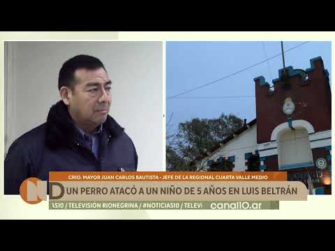 Un perro atacó a un niño de 5 años en Luis Beltrán: sufrió heridas y debió recibir atención médica