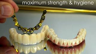 Maximize Strength & Hygiene Without Sacrificing Esthetics