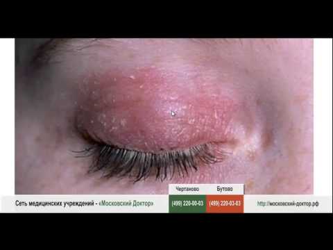 Ультразвуковая анатомия коленного сустава Изгиб позвоночника в шейном лордозе