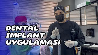Dental İmplant: Periodontoloji Uzmanından Hasta Üzerinde Uygulamalı Anlatım
