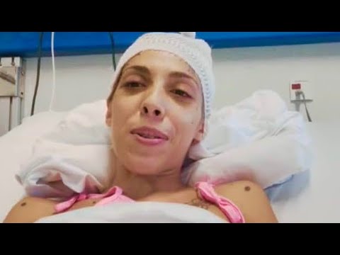 DOPO L'INCIDENTE ARIANNA RISCHIA LA PARALISI: "MA SONO VIVA E CERCO L'ANGELO CHE MI HA SOCCORSA"