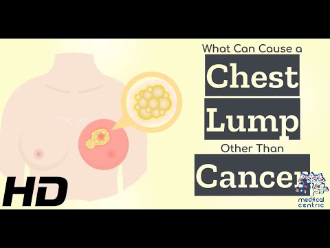 All About Allergy Shots