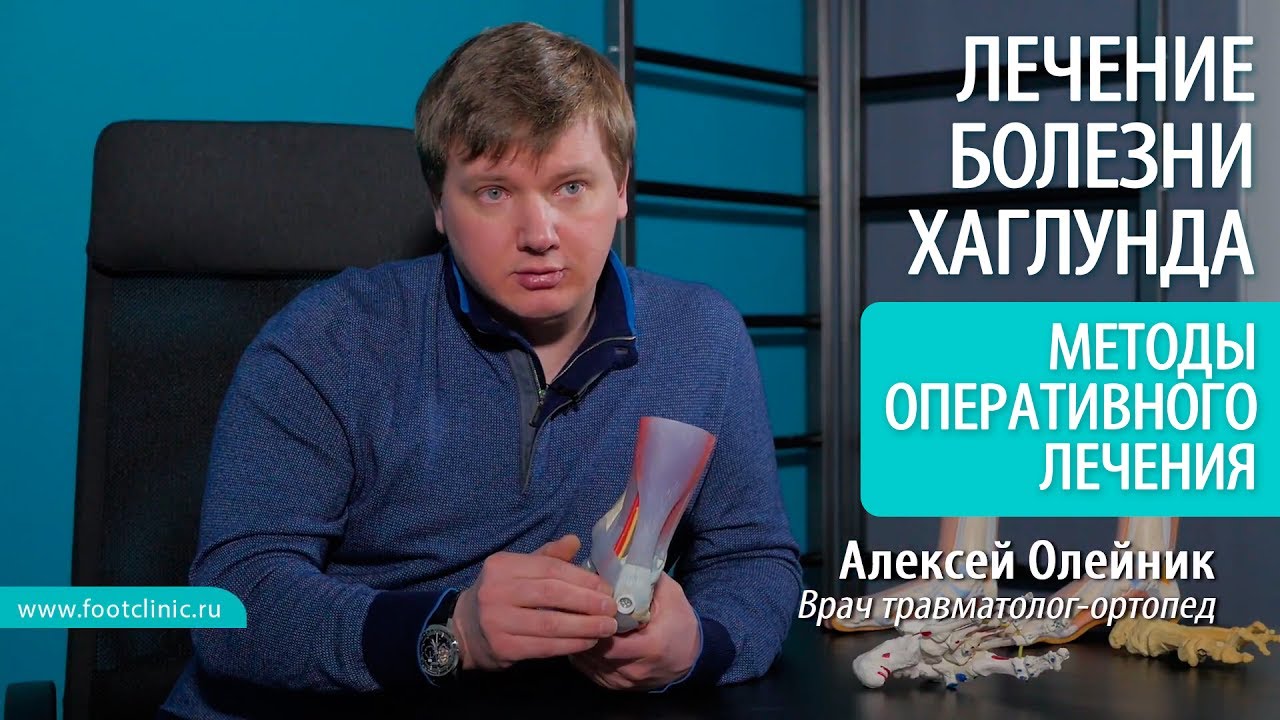 Видео по теме Деформация Хаглунда