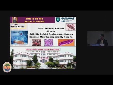 Prof Pradeep B Bhosale - THR in TB Hips Active & Healed