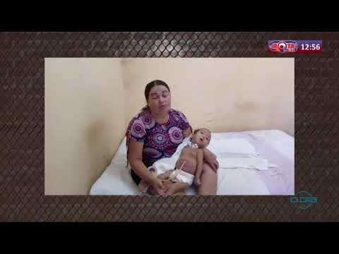 MaÌƒe faz apelo para ajudar filha que nasceu com graves problemas (29 05 20)