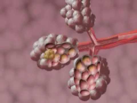 Asbestos-Related Diseases