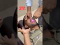 CFR for Vertigo & Migraine. #trend #ytshorts #shorts