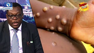 NCDC DG On Monkeypox, Lassa Fever, Cholera In Nigeria| Sunrise Daily