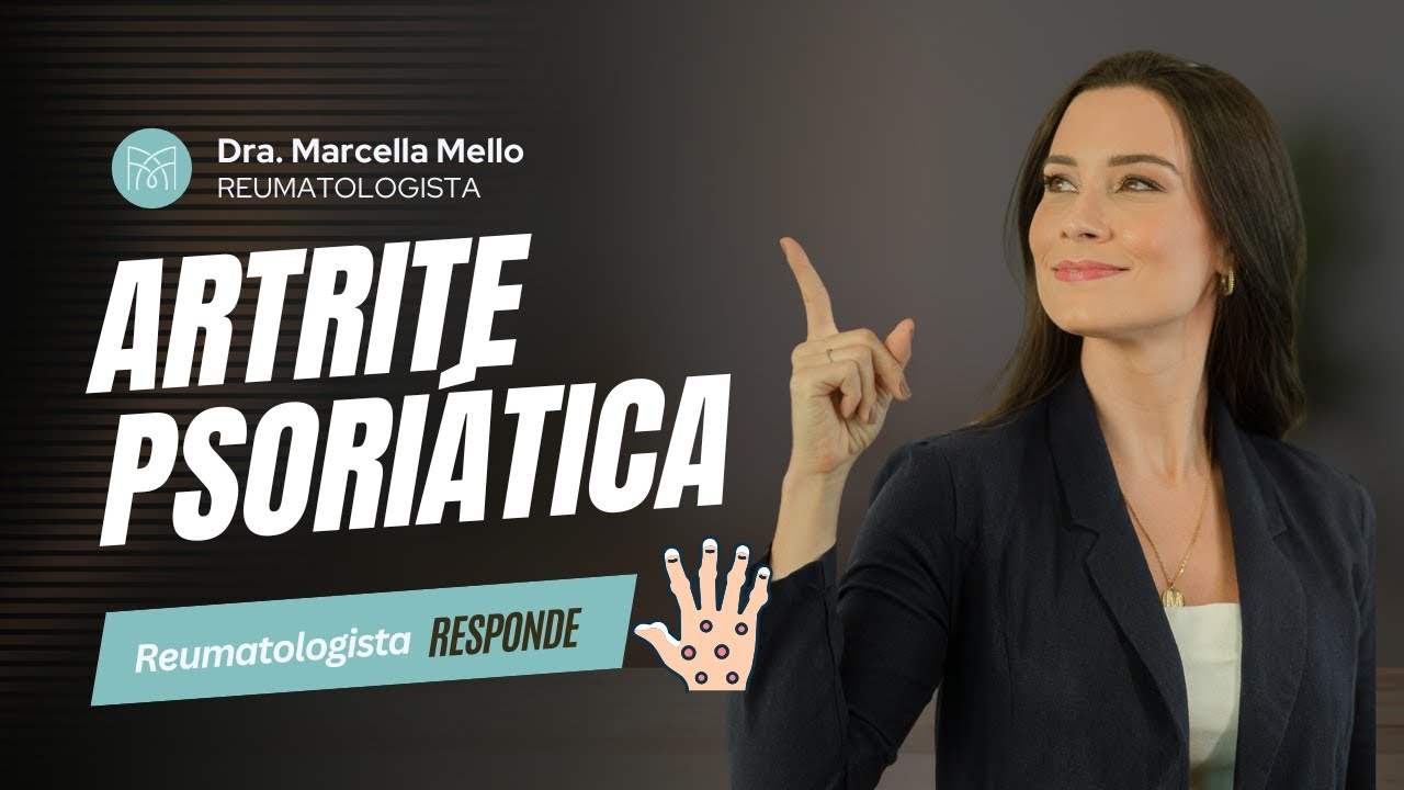 O que eu preciso saber artrite psoriática