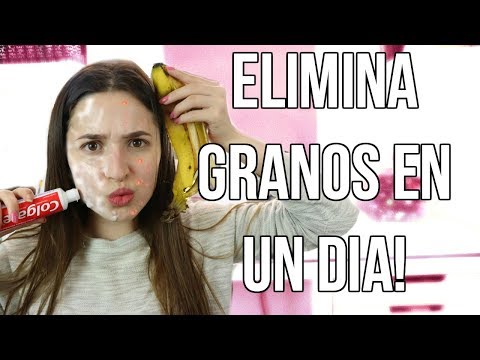 download lagu mp3 mp4 Acabar Con Los Granos Dela Cara, download lagu Acabar Con Los Granos Dela Cara gratis, unduh video klip Acabar Con Los Granos Dela Cara