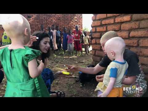 Life-saving skin checks for albinism in Uganda