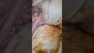 Fat Killers Food That Makes You Go Thin | Burnning Fat While Eating| Must Watch!