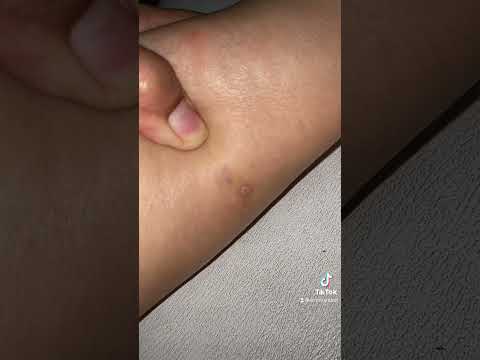 PENGALAMAN DAN CARA MENGHILANGKAN KUTU KUCING / PINJAL / KUTU LONCAT DI DALAM RUMAH