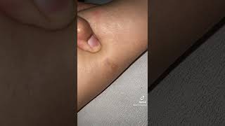 Download lagu PENGALAMAN DAN CARA MENGHILANGKAN KUTU KUCING / PINJAL / KUTU LONCAT DI DALAM RUMAH mp3
