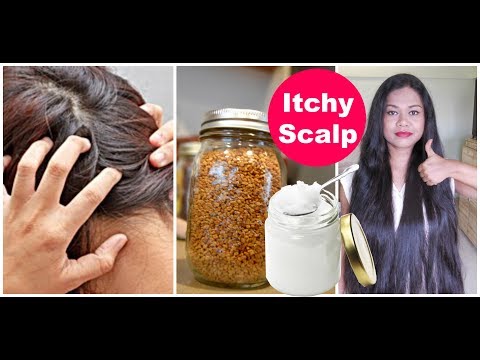 Home Remedies For An Itchy Scalp 