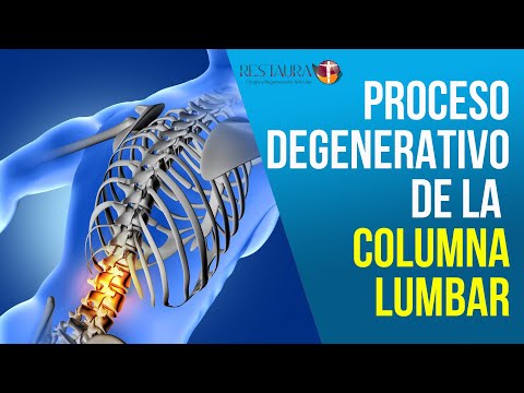 Ungüento en dolor severo en las articulaciones Causas sinovitis de cadera