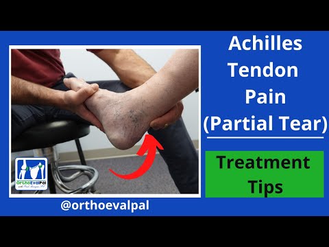 Metatarsalgia and Morton s Neuroma Evaluation and Treatment