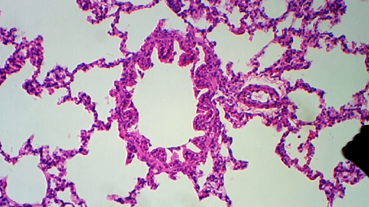 Histologia do Pulmão